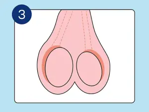 Illustration der Nebenhoden