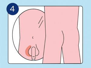 Illustration der Hoden im Spiegel um Veränderungen zu bemerken
