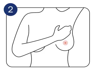 Illustration eines weiblichen Oberkörpers, eine Hand tastet die Brust ab