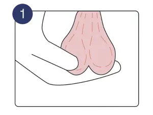 Schritt 1: Hoden von unten abtasten. | Pronova BKK