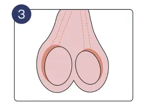 Schritt 3: Nebenhoden sind auch abtastbar. | Pronova BKK