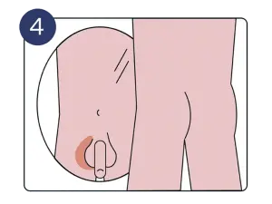 Schritt 4: Hoden im Spiegel anschauen. | Pronova BKK
